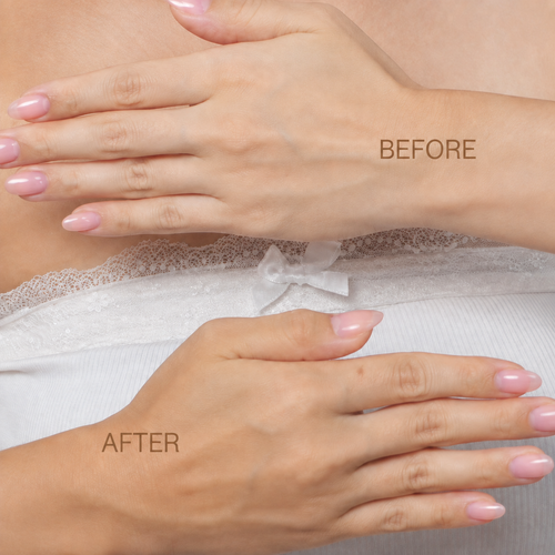 Pixi GradualGlow sunless tanner Before and After view on hands. view 2